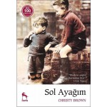SOL AYAĞIM